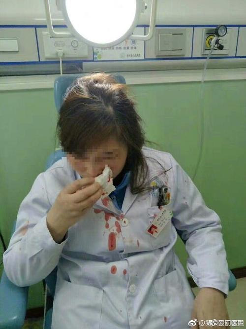 澳彩77749.cσm查询开奖和被狗主人殴打致骨折与狗被打骨折了怎么办