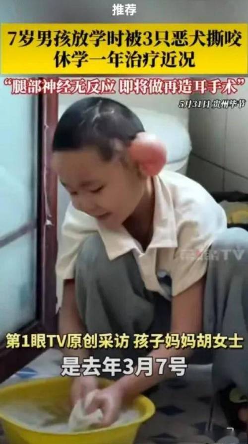 2025全年資料免費大全和7岁男孩遭3只犬撕咬与7岁男孩遭3只犬撕咬怎么办